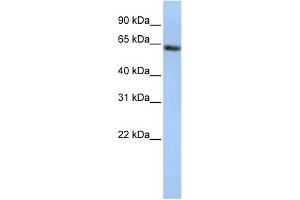 WB Suggested Anti-FANCE Antibody Titration: 0. (FANCE Antikörper  (Middle Region))