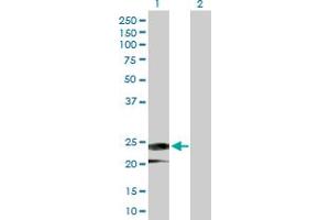 Western Blot analysis of IFNA14 expression in transfected 293T cell line by IFNA14 MaxPab polyclonal antibody. (IFNa14 Antikörper  (AA 1-189))