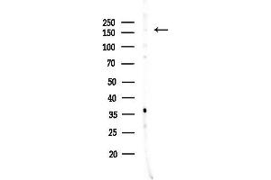 Western blot analysis of lysates from HepG2 cells(heat-shock,45 min treatment), using PIK3C2G Antibody at 1/1000 dilution.