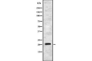 Western blot analysis of MRPS11 using MCF7 whole cell lysates (MRPS11 Antikörper  (C-Term))