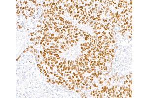 Immunohistochemistry (IHC) image for anti-MutS Homolog 6 (E. Coli) (MSH6) (AA 1310-1360) antibody (ABIN7453979)