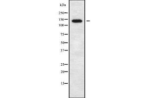 Western blot analysis of CTNND2 using COLO205 whole cell lysates (CTNND2 Antikörper  (C-Term))