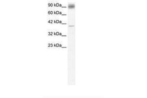 Image no. 3 for anti-Nuclear Factor of kappa Light Polypeptide Gene Enhancer in B-Cells 2 (NFKB2) (AA 711-758) antibody (ABIN6735824) (NFKB2 Antikörper  (AA 711-758))