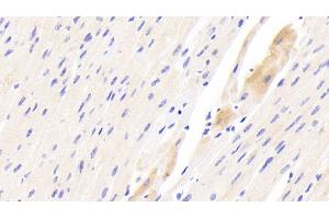 Detection of TSPO in Human Cardiac Muscle Tissue using Polyclonal Antibody to Translocator Protein (TSPO) (TSPO Antikörper  (AA 1-169))