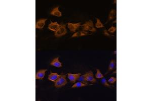Immunofluorescence analysis of C6 cells using B2 Rabbit pAb (ABIN6127467, ABIN6137310, ABIN6137311 and ABIN6225253) at dilution of 1:100. (ATP1B2 Antikörper  (AA 68-290))
