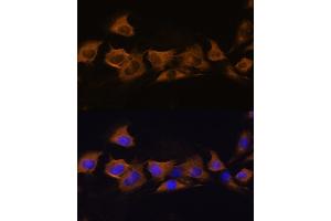 Immunofluorescence analysis of C6 cells using B2 Rabbit pAb (ABIN6127467, ABIN6137310, ABIN6137311 and ABIN6225253) at dilution of 1:100. (ATP1B2 Antikörper  (AA 68-290))