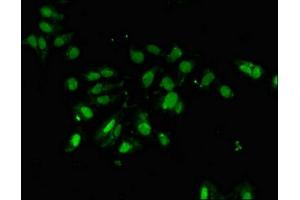 Immunofluorescent analysis of Hela cells using ABIN7162710 at dilution of 1:100 and Alexa Fluor 488-congugated AffiniPure Goat Anti-Rabbit IgG(H+L) (PCID2 Antikörper  (AA 2-250))