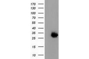 Western Blotting (WB) image for anti-Phenazine Biosynthesis-Like Protein Domain Containing 1 (PBLD1) antibody (ABIN1499328)