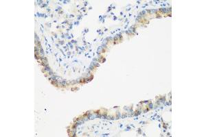 Immunohistochemistry of paraffin-embedded mouse lung using IGF2BP3 antibody (ABIN5972501) at dilution of 1/200 (40x lens). (IGF2BP3 Antikörper)