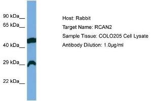Host: Rabbit Target Name: RCAN2 Sample Type: COLO205 Whole Cell lysates Antibody Dilution: 1.
