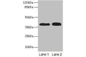 Western blot All lanes: CTSL antibody at 12 μg/mL Lane 1: A549 whole cell lysate Lane 2: HepG2 whole cell lysate Secondary Goat polyclonal to rabbit IgG at 1/10000 dilution Predicted band size: 38 kDa Observed band size: 38 kDa (Cathepsin L Antikörper  (AA 114-333))