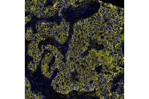 Immunofluorescence (IF) image for anti-Cadherin 1, Type 1, E-Cadherin (Epithelial) (CDH1) (AA 155-707) antibody (ABIN7454024)