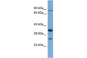 Host:  Rabbit  Target Name:  SLC6A9  Sample Type:  THP-1 Whole cell lysates  Antibody Dilution:  1.