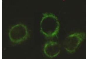 Immunocytochemistry stain of Hela using Pyruvate Dehydrogenase E2 mouse mAb (1:300). (CYB561 Antikörper)