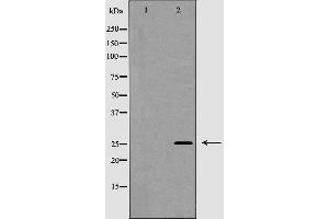 Western blot analysis of NGF beta expression in Jurkat cells,The lane on the left is treated with the antigen-specific peptide. (Nerve Growth Factor Antikörper  (Internal Region))