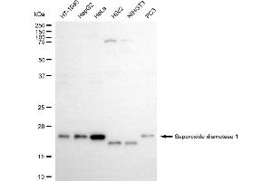Western blotting analysis using superoxide dismutase 1 antibody (ABIN7800461).