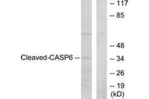 Western Blotting (WB) image for anti-Caspase 6, Apoptosis-Related Cysteine Peptidase (CASP6) (AA 144-193), (Cleaved-Asp162) antibody (ABIN2891156) (Caspase 6 Antikörper  (Cleaved-Asp162))