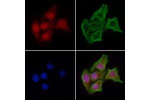 ABIN6263956 and ABIN6268907 staining HepG2 cells by IF/ICC. (p300 Antikörper  (N-Term))