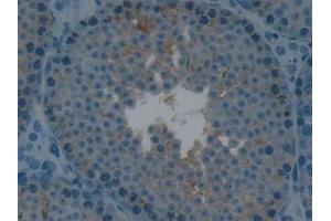 Detection of LTbR in Mouse Testis Tissue using Polyclonal Antibody to Lymphotoxin Beta Receptor (LTbR) (LTBR Antikörper  (AA 128-395))