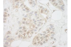 anti-Uridine-Cytidine Kinase 1-Like 1 (UCKL1) (AA 1-50) antibody