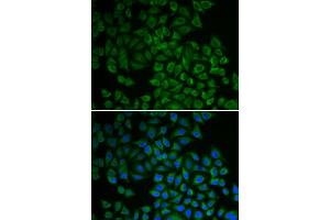 Immunofluorescence analysis of HeLa cell using SGK1 antibody.