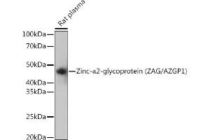 Western blot analysis of extracts of Rat plasma, using Zinc-α2-glycoprotein (ZAG/) Rabbit mAb (ABIN7265556) at 1:1000 dilution. (AZGP1 Antikörper)