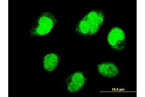 Immunofluorescence of monoclonal antibody to PAX7 on HeLa cell. (PAX7 Antikörper  (AA 411-520))