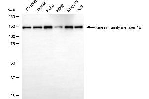 Western blotting analysis using kinesin family member 1B antibody (ABIN7799201). (KIF1B Antikörper)