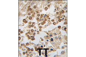 Formalin-fixed and paraffin-embedded human testis tissue reacted with DPPA4 polyclonal antibody  , which was peroxidase-conjugated to the secondary antibody, followed by DAB staining. (DPPA4 Antikörper  (N-Term))