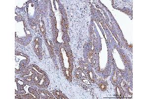 IHC analysis of GLUD1/2 using anti-GLUD1/2 antibody (ABIN7602000). (GLUD1 / GLUD2 (AA 54-553) Antikörper)