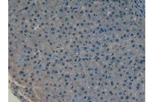 Detection of CLL1 in Human Liver Tissue using Polyclonal Antibody to Collectin Liver 1 (CLL1) (COLEC10 Antikörper  (AA 34-277))