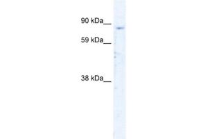 Western Blotting (WB) image for anti-Sirtuin 1 (SIRT1) antibody (ABIN2460449) (SIRT1 Antikörper)