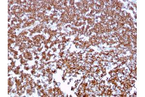 Immunohistochemistry (IHC) image for anti-Membrane-Spanning 4-Domains, Subfamily A, Member 1 (MS4A1) (AA 213-297) antibody (ABIN6941105)