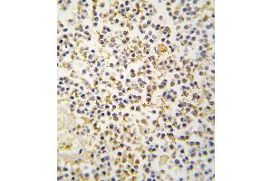 Formalin-fixed and paraffin-embedded human kideny tissue reacted with ALDH1A3 antibody (N-term), which was peroxidase-conjugated to the secondary antibody, followed by DAB staining. (ALDH1A3 Antikörper  (N-Term))