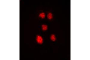 Immunofluorescent analysis of ZNF148 staining in Hela cells.