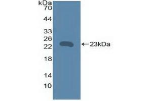 Western blot analysis of recombinant Human TNFRSF5. (CD40 Antikörper  (AA 26-187))