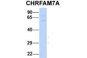 Host:  Rabbit  Target Name:  CHRFAM7A  Sample Type:  Human Fetal Muscle  Antibody Dilution:  1. (CHRFAM7A Antikörper  (Middle Region))
