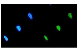 IF analysis of EIF2B1 using anti-EIF2B1 antibody (ABIN7602821).