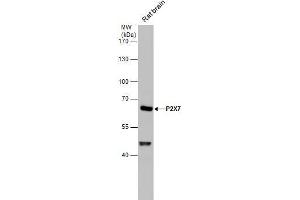 P2RX7 antibody  (Center)