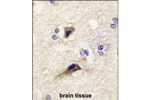 Formalin-fixed and paraffin-embedded human brain tissue reacted with NTF3 antibody , which was peroxidase-conjugated to the secondary antibody, followed by DAB staining. (Neurotrophin 3 Antikörper  (AA 122-151))