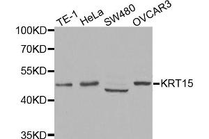 Western blot analysis of extracts of various cell lines, using KRT15 antibody (ABIN5971439) at 1:400 dilution. (KRT15 Antikörper)