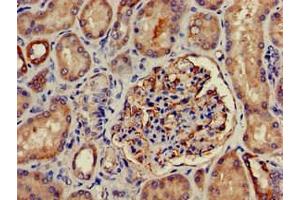 Immunohistochemistry of paraffin-embedded human kidney tissue using ABIN7169035 at dilution of 1:100 (PRKD3 Antikörper  (AA 326-510))