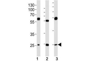 Western blot analysis of lysate from (1) HeLa, (2) HepG2 and (3) U-2OS cell line using TFAM antibody at 1:1000. (TFAM Antikörper  (AA 216-246))