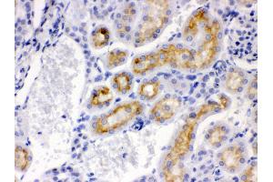 Immunohistochemistry (IHC) image for anti-Cytochrome P450, Family 24, Subfamily A, Polypeptide 1 (CYP24A1) (AA 153-514) antibody (ABIN3042784)