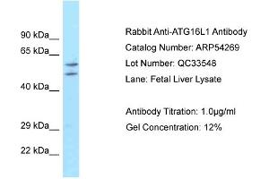 WB Suggested Anti-ATG16L1 Antibody Titration: 0. (ATG16L1 Antikörper  (Middle Region))