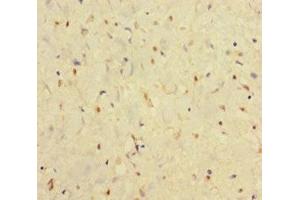 Immunohistochemistry of paraffin-embedded human smooth muscle tissue using ABIN7156578 at dilution of 1:100 (IFNAR2 Antikörper  (AA 27-243))