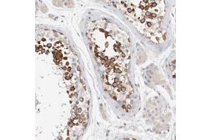 Immunohistochemical staining (Formalin-fixed paraffin-embedded sections) of human testis with STK31 polyclonal antibody  shows strong cytoplasmic positivity in developing sperm cells.