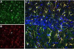 Multiplex staining of CLEC7A and GFAP in rat hippocampal CA1 regionImmunohistochemical staining of perfusion-fixed frozen rat brain sections with Anti-CLEC7A/Dectin-1 (extracellular) Antibody (ABIN7237603, ABIN7316623 and ABIN7316624), (1:600), followed by goat anti-rabbit-AlexaFluor-488 and Guinea Pig Anti-GFAP Antibody (ABIN7237688, ABIN7316585 and ABIN7316586), (1:600), followed by goat anti-guinea pig-AlexaFluor-594. (Glial Fibrillary Acidic Protein (GFAP) Peptid)