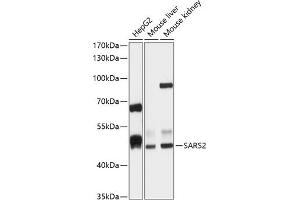 Western blot analysis of extracts of various cell lines, using S antibody (ABIN6132970, ABIN6147387, ABIN6147388 and ABIN6215904) at 1:1000 dilution. (SARS2 Antikörper  (AA 289-518))