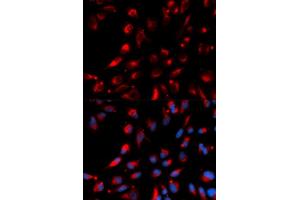 Immunofluorescence analysis of U2OS cells using CPE antibody (ABIN5973172). (CPE Antikörper)